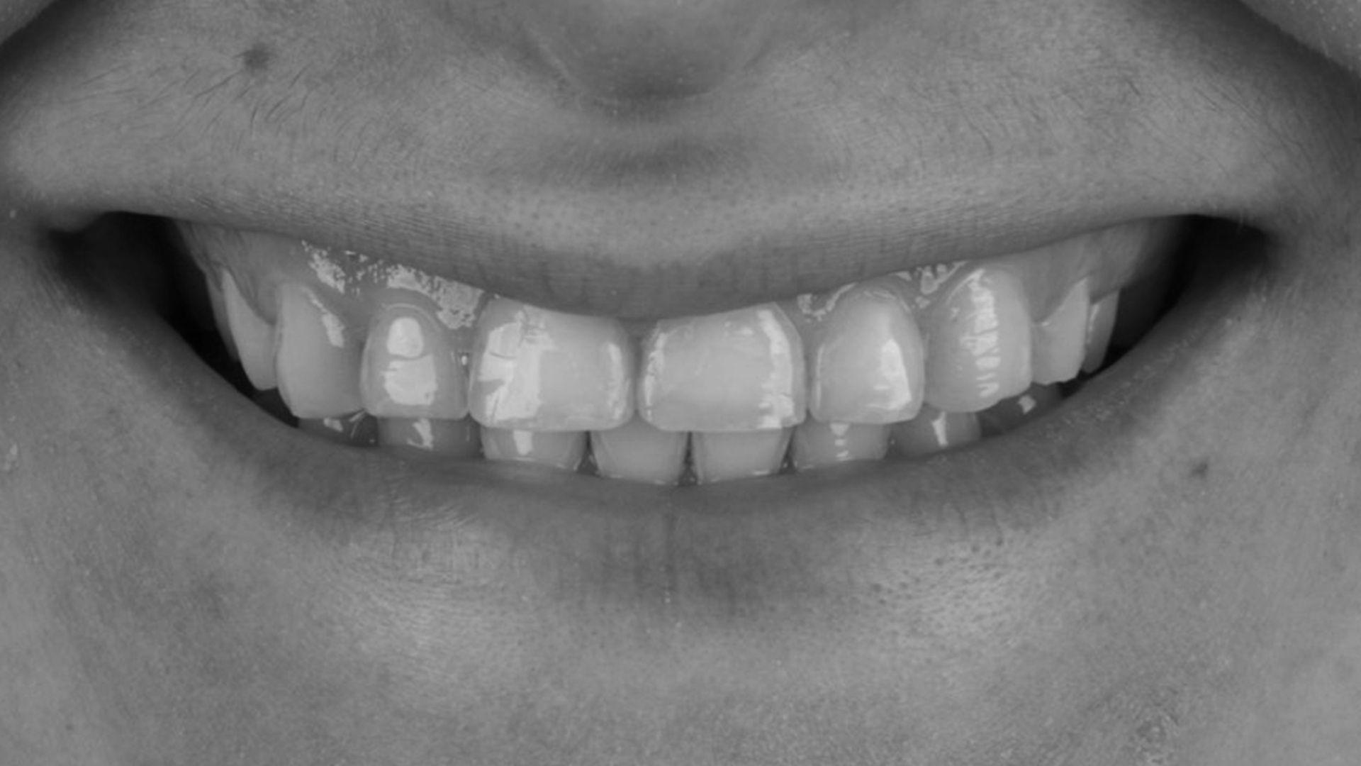 tooth before