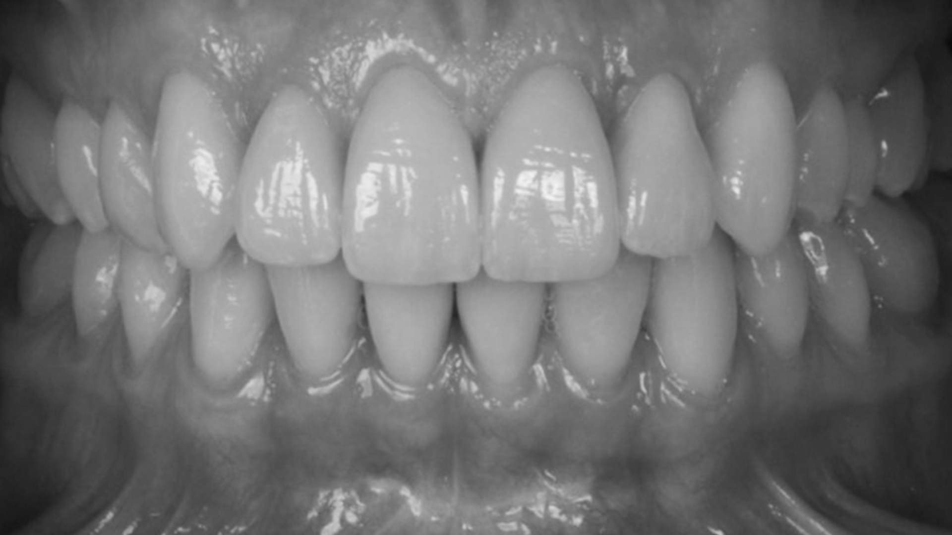 tooth