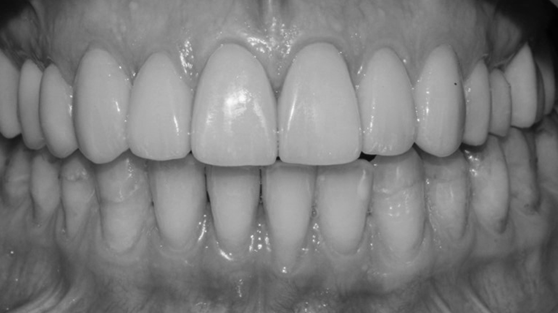 tooth before