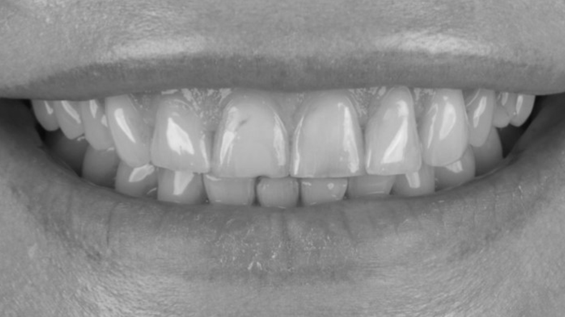 tooth before
